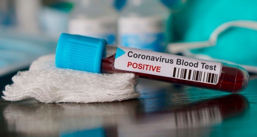 Confirman primer caso de Coronavirus en La Paloma