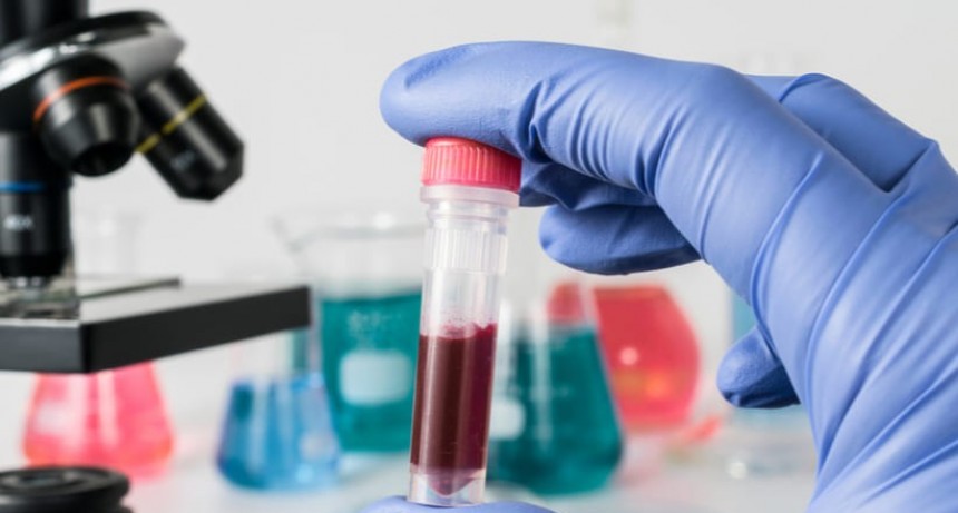 Cure Rocha presentará el Laboratorio de Análisis de COVID-19