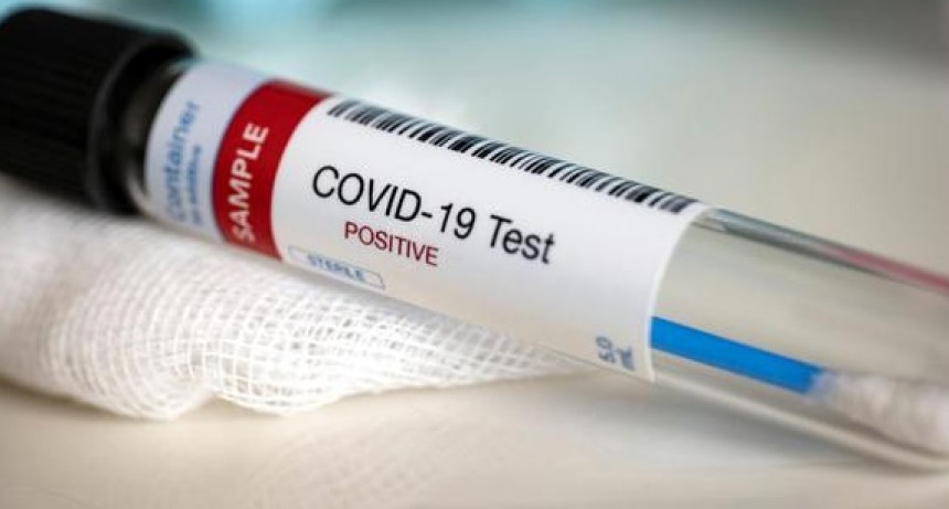Confirman resultado positivo de COVID 19 en La Paloma