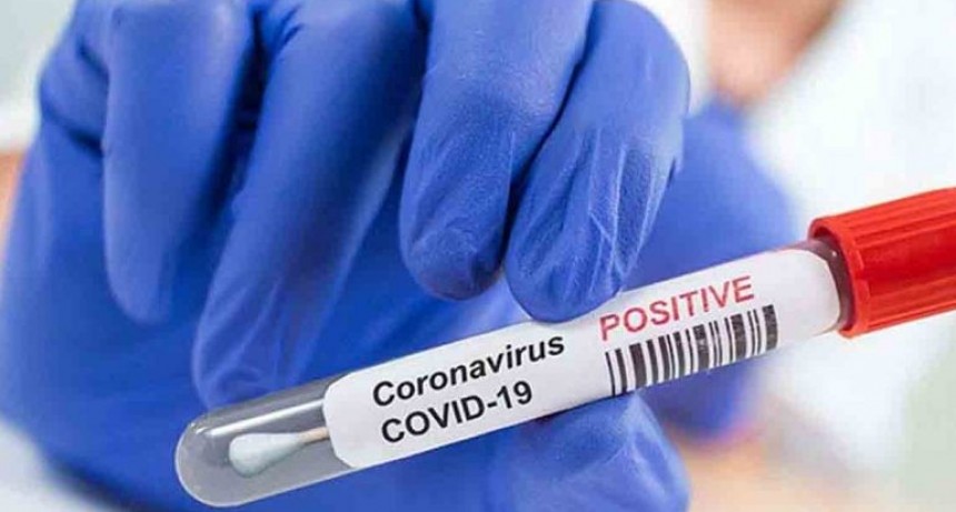 Confirman nuevo caso de COVID19 en La Paloma